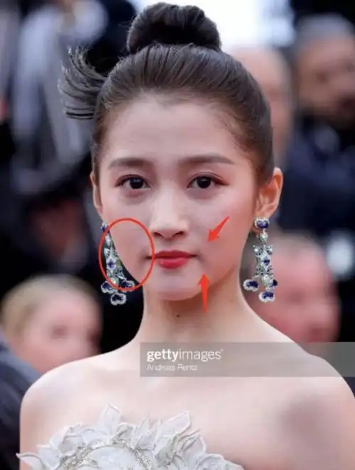 百万修图师也p不出的少女感关晓彤的脸到底哪里出了问题