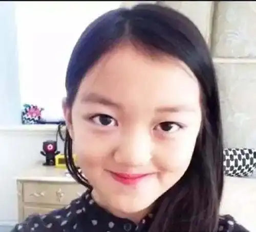 王菲12岁女儿和冯小刚28岁女儿,同患兔唇,简直就是天壤之别!