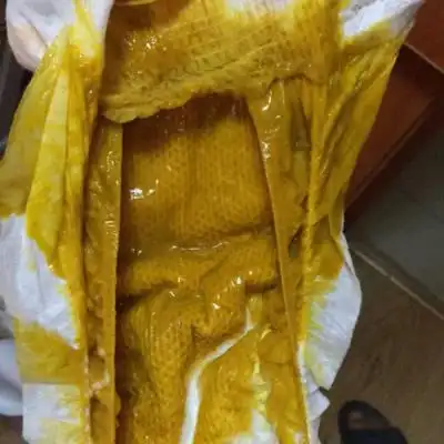 两个月女宝,月子里母乳性腹泻,胃胀气,每天拉屎放屁都觉得痛苦,频繁的