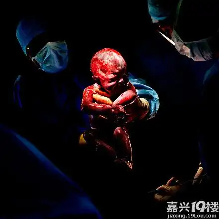 实拍婴儿刚出生的样子口味略重慎点