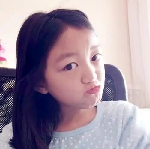 图王菲女儿兔唇原因是什么与五个因素相关