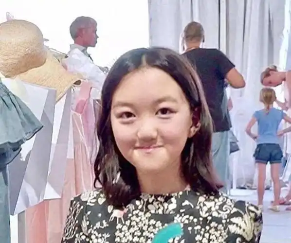 王菲女儿兔唇终痊愈欣喜迎接新生活