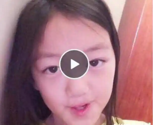 王菲李亚鹏女儿近照曝光,长大后兔唇修复后的她是如此的活泼